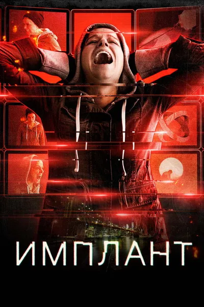Имплант (2021)